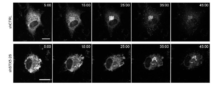 Delayed CCL26 trafficking in the secretory pathway of STX5 depleted ...